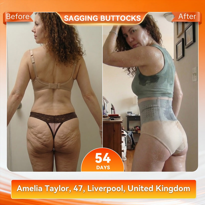 2026 Moringa & Berberine 4-in-1 Micro-Particle Shaping & Fat Burning Shorts - image 4