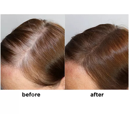 ⏳BUY 1 GET 1 FREE + 50% OFF! ⏰Perfect Eyebrow & Hair Concealer w/ Stencil